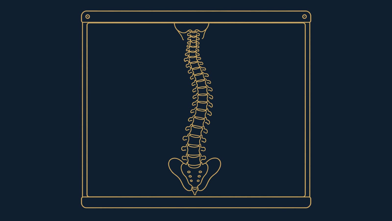 A spine X-ray on a light box